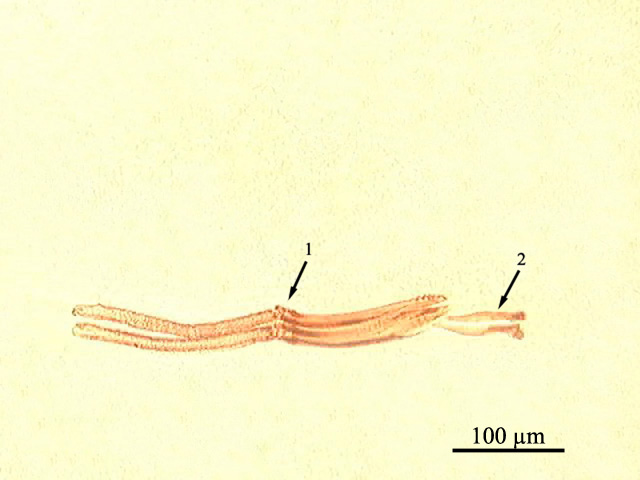 Structures of some widely distributed lung helminths (b)